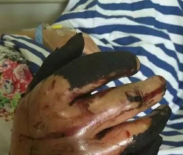 香港今晚开奖结果开奖记录和女子遭毒蛇咬伤身亡与女子遭毒蛇咬伤身亡视频
