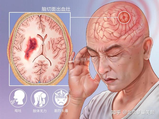 新2025澳门天天开好彩和歌手突发脑溢血去世与著名歌唱家脑溢血